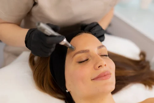 Nanoneedling, soin anti-âge par Stress-Off St Médard en Jalles